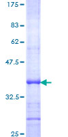 12.5% SDS-PAGE Stained with Coomassie Blue.